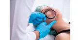 4 dôvody, prečo sa v boji s akné oplatí obrátiť na dermatológa