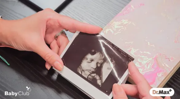 Cesta k rodičovstvu: Čo by ste mali vedieť v začiatkoch tehotenstva?