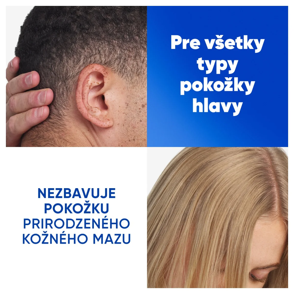 Head & Shoulders Deep Hydration šampón 1×500 ml, šampón proti lupinám