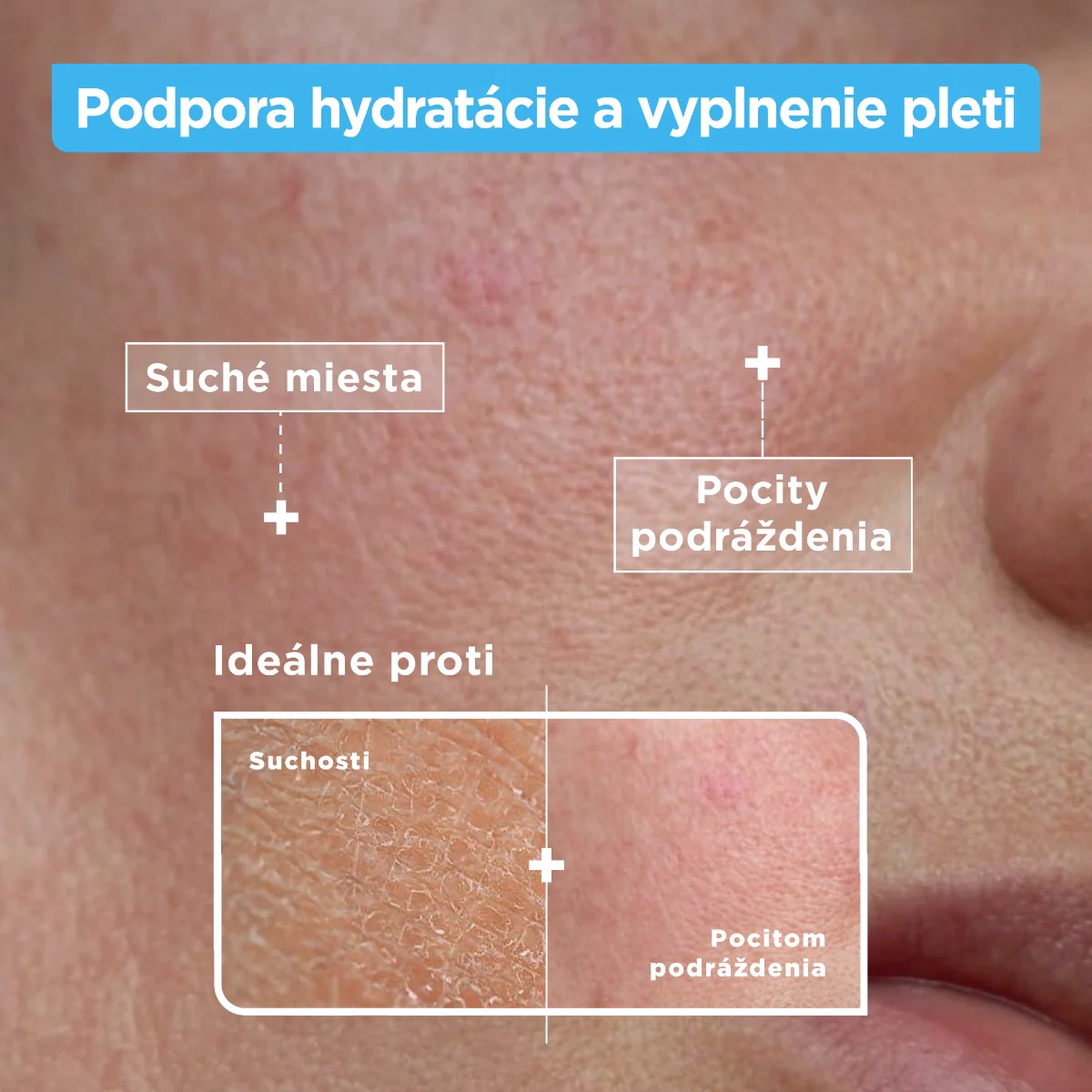 Mixa Sensitive Skin Expert hydratačné sérum proti vysušovaniu 1×30 ml, hydratačné sérum