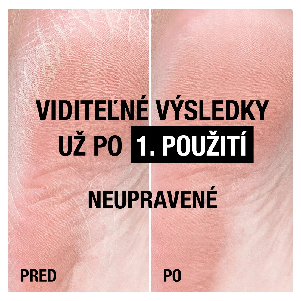 NEUTROGENA® Intenzívny regeneračný CICA balzam na chodidlá s Nórskou receptúrou 1×50 ml, regeneračný balzam