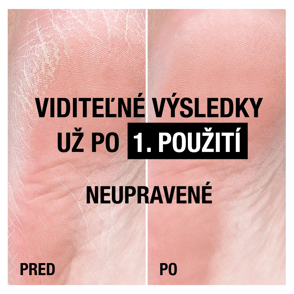 NEUTROGENA® Ultra výživný krém na chodidlá s Nórskou receptúrou 1×100 ml, krém na nohy