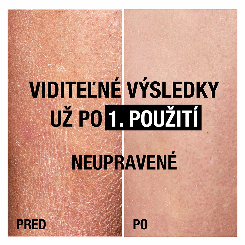 NEUTROGENA® Hĺbkovo hydratačné telové mlieko s mandľovým olejom s Nórskou receptúrou 1×400 ml, hydratačné telové mlieko