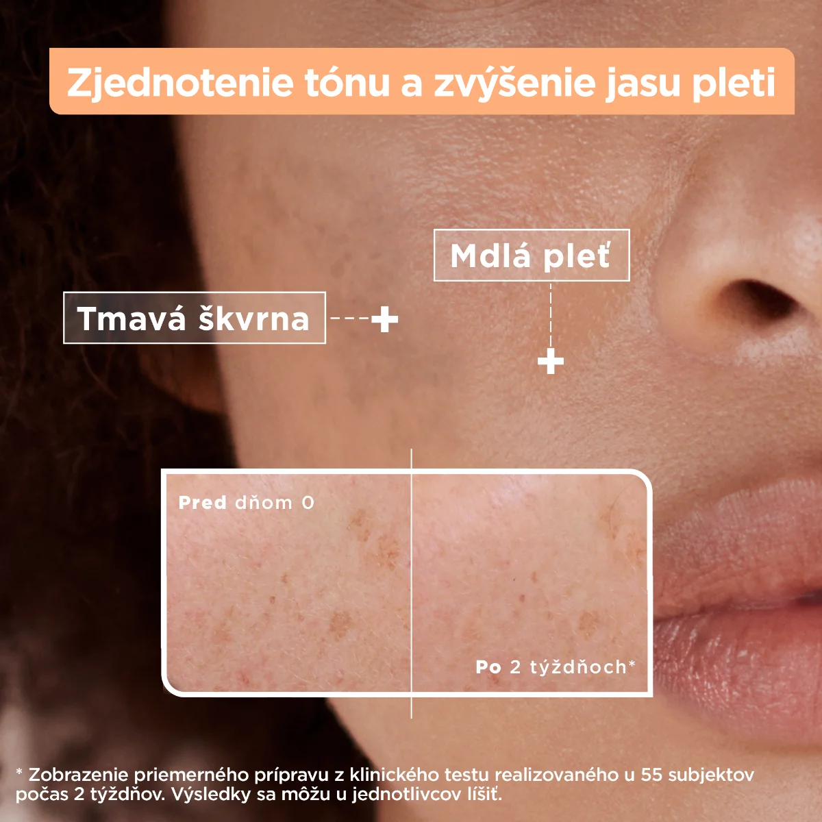 Mixa Sensitive Skin Expert sérum proti tmavým škvrnám 1×30 ml, sérum proti tmavým škvrnám